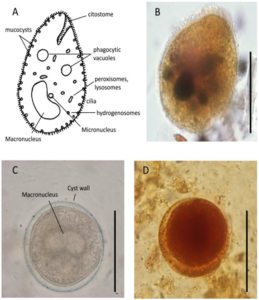 BALANTIDIUM COLI